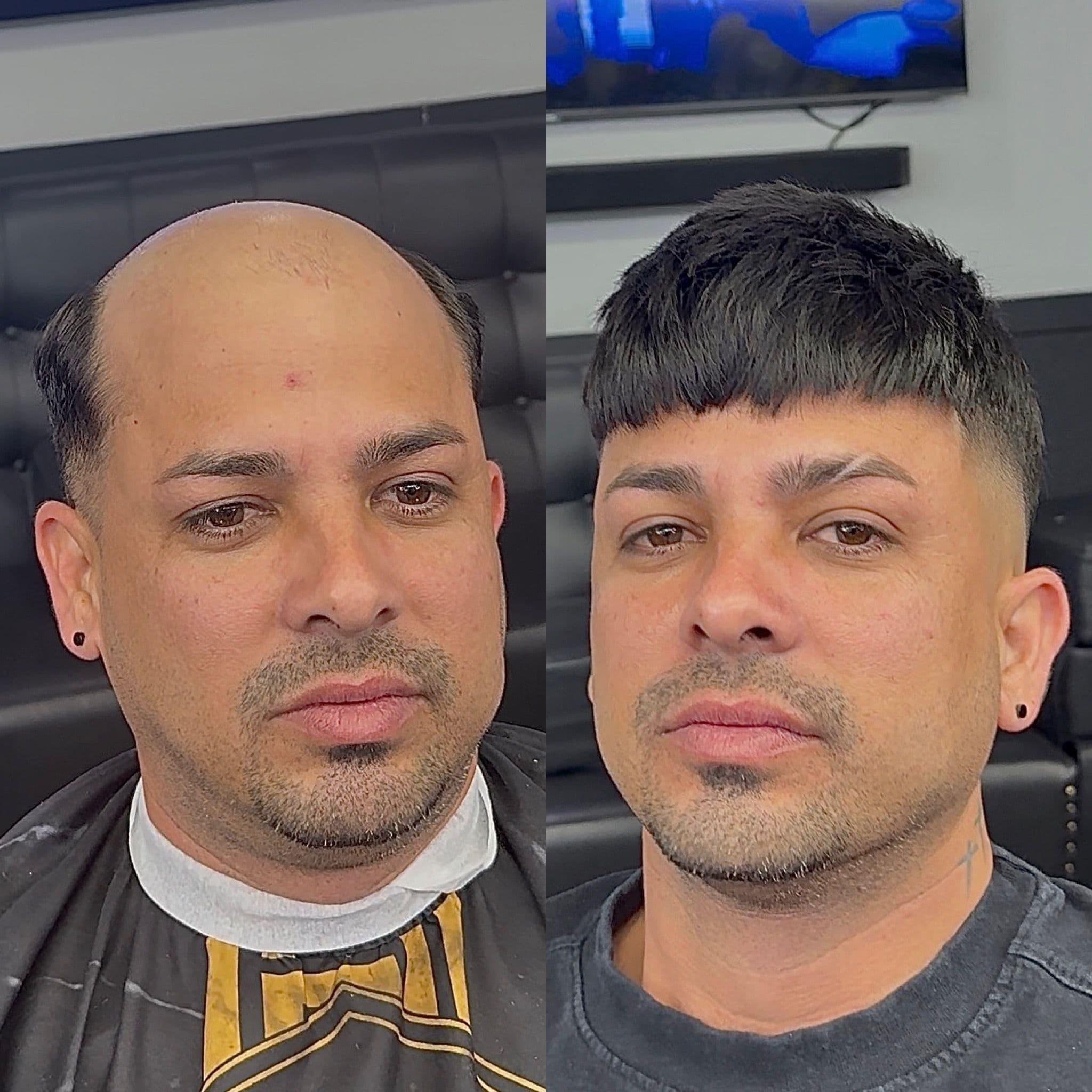 Transformación 1 — Antes y Después