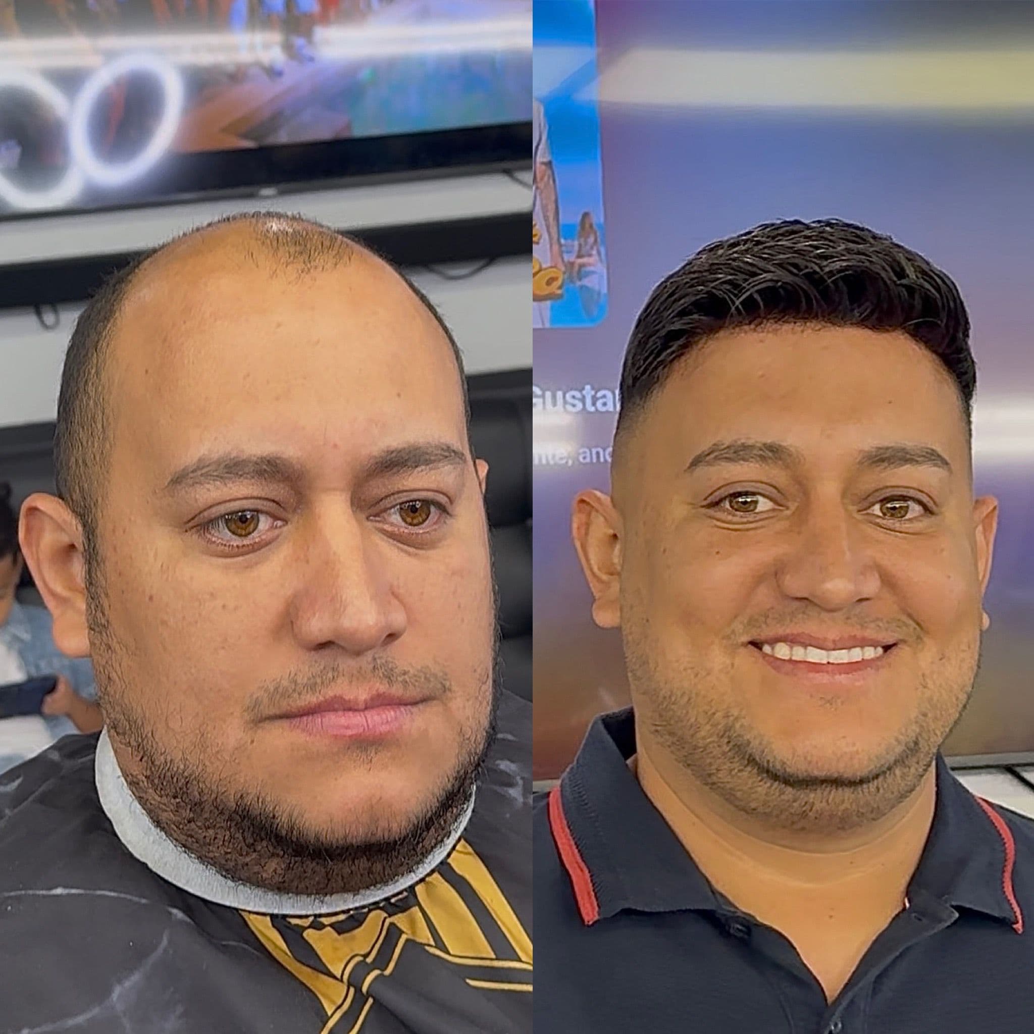 Transformación 2 — Antes y Después