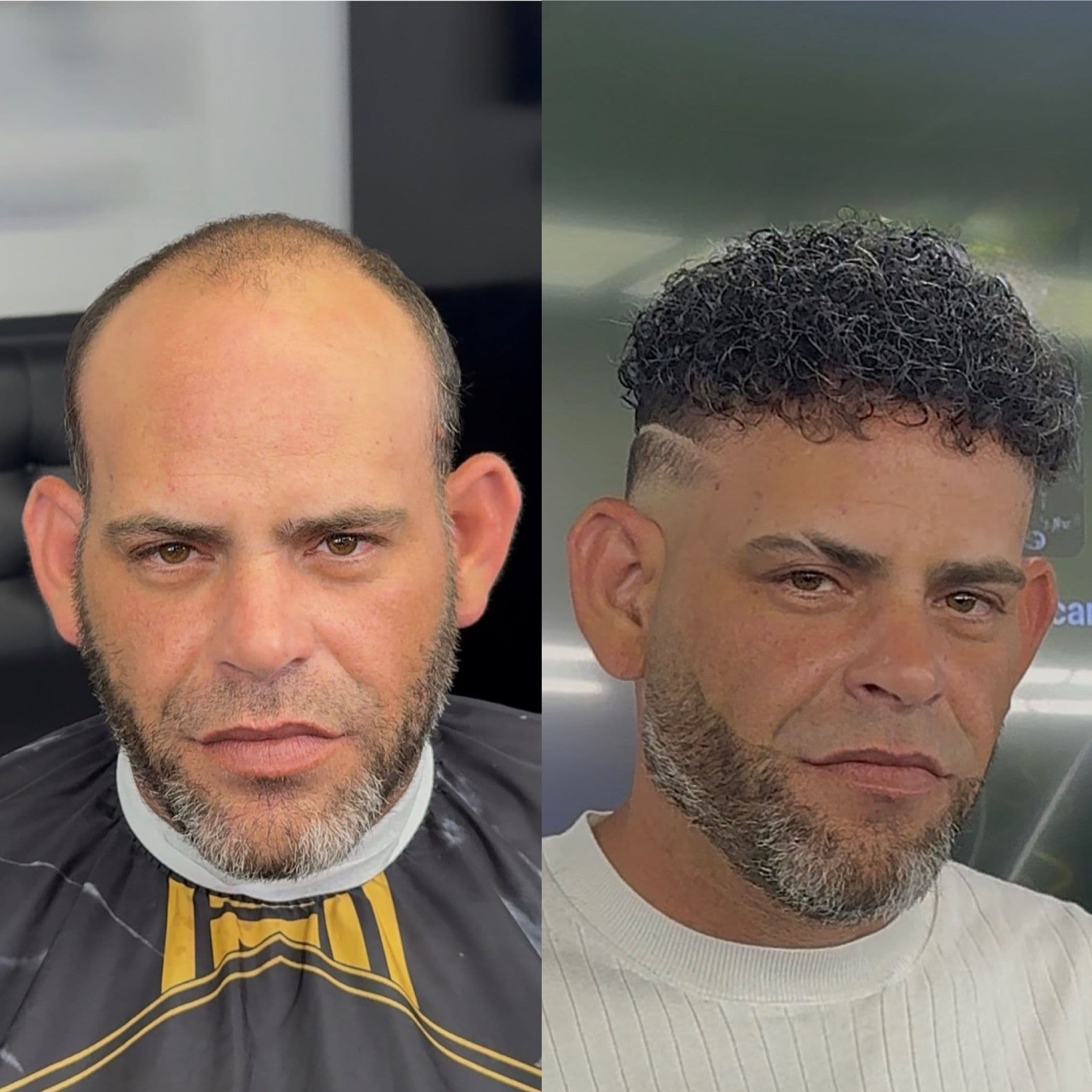 Transformación 3 — Antes y Después