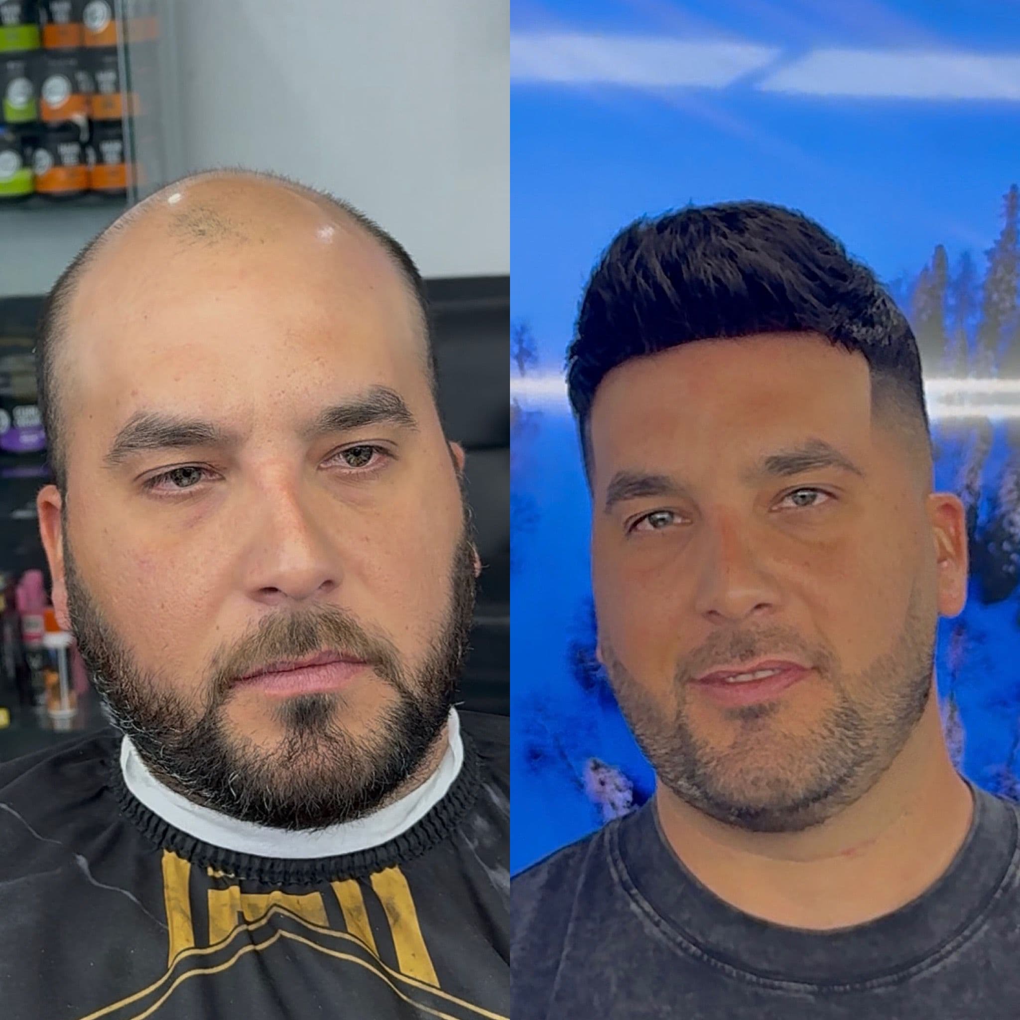 Transformación 4 — Antes y Después