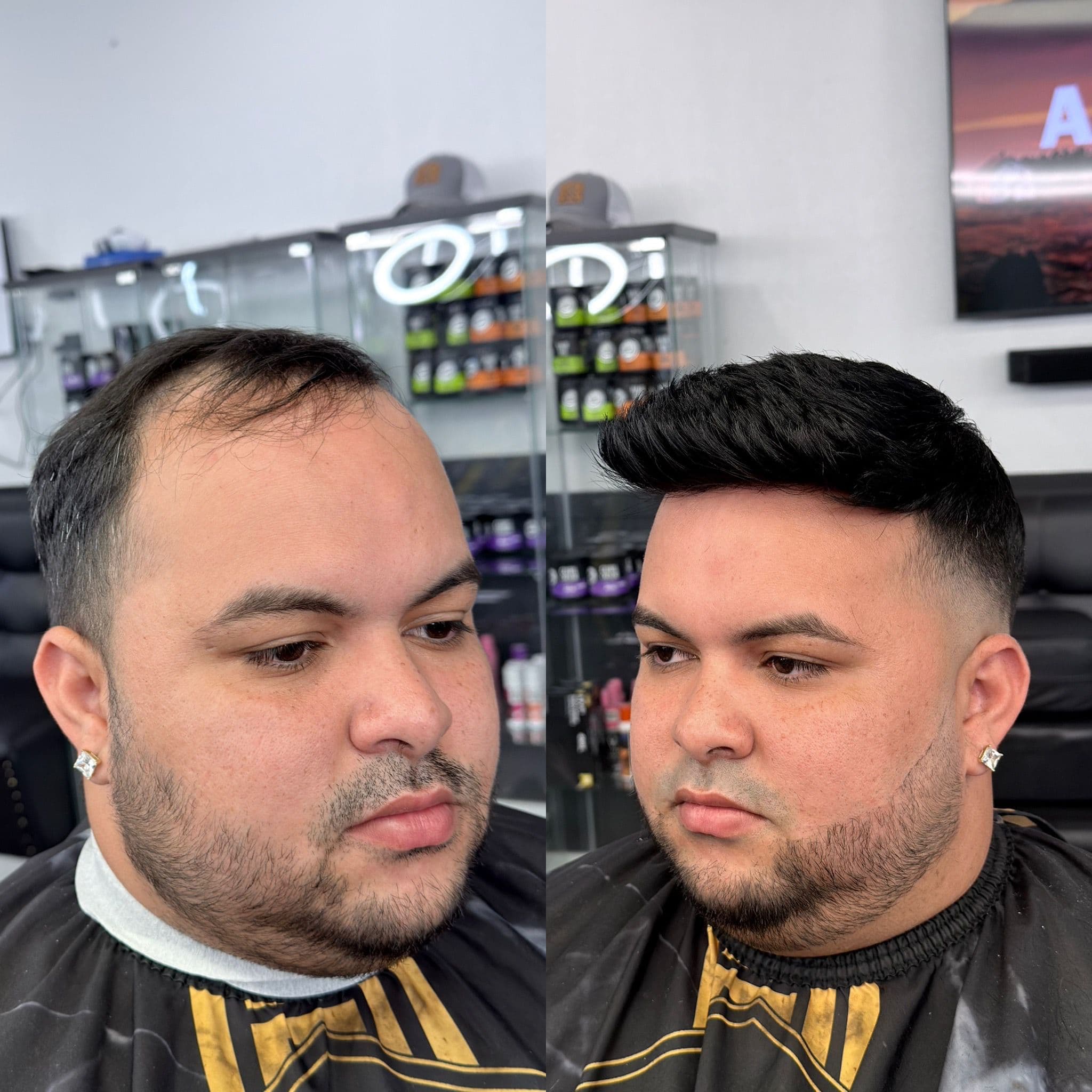 Transformación 5 — Antes y Después