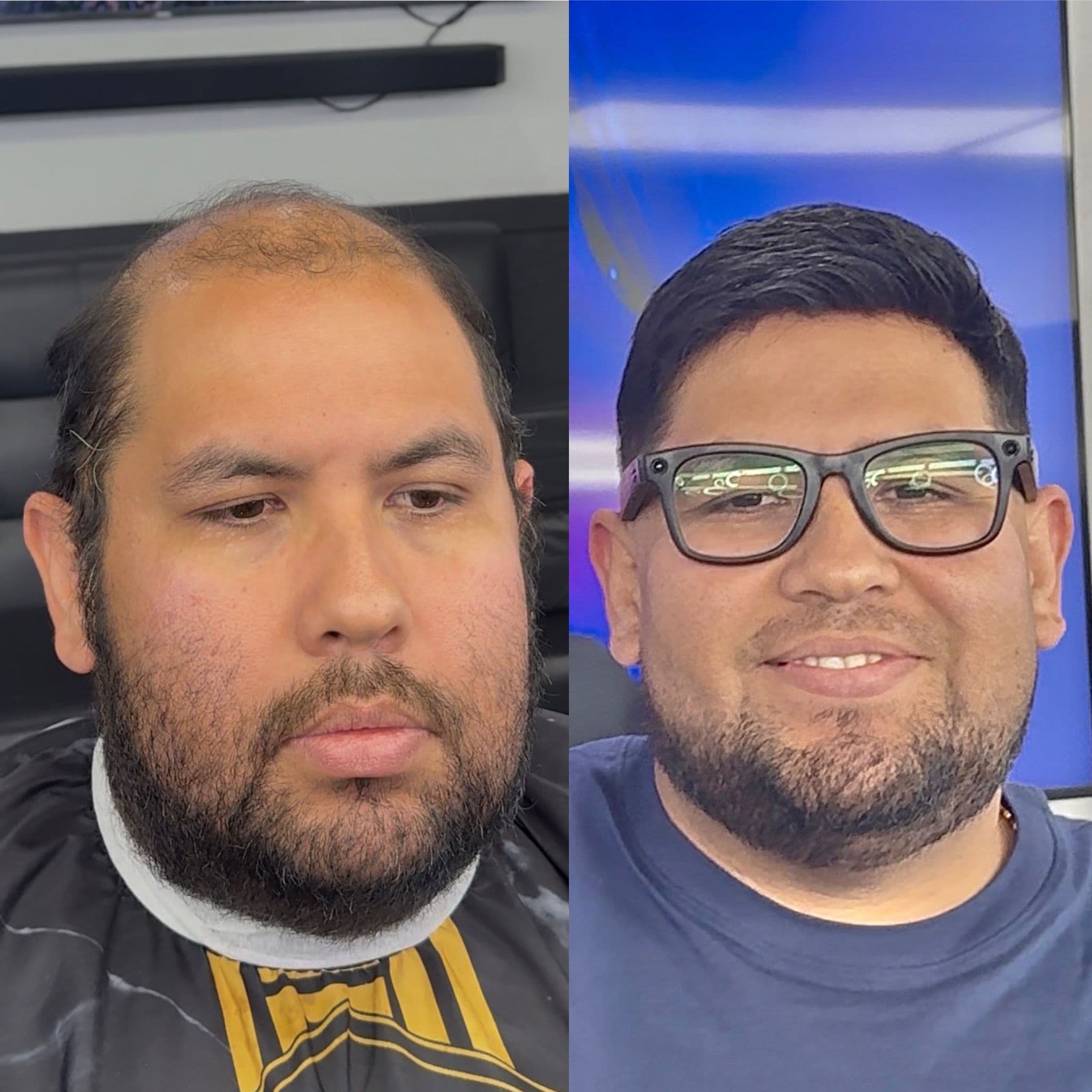 Transformación 6 — Antes y Después