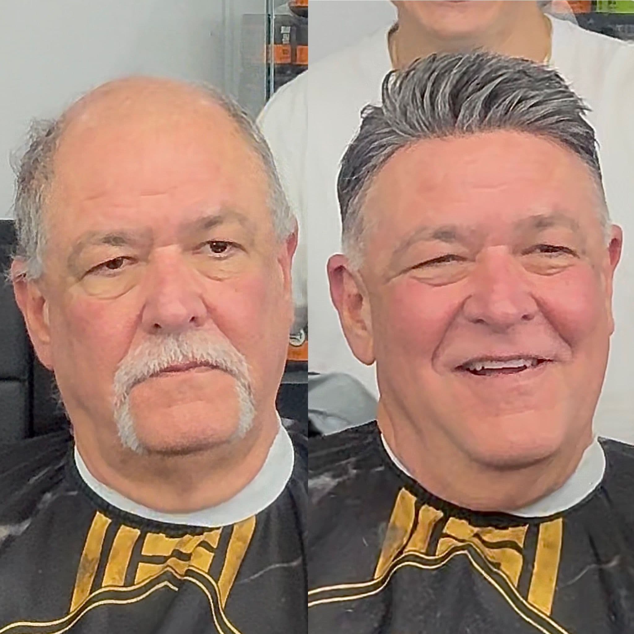 Transformación 7 — Antes y Después