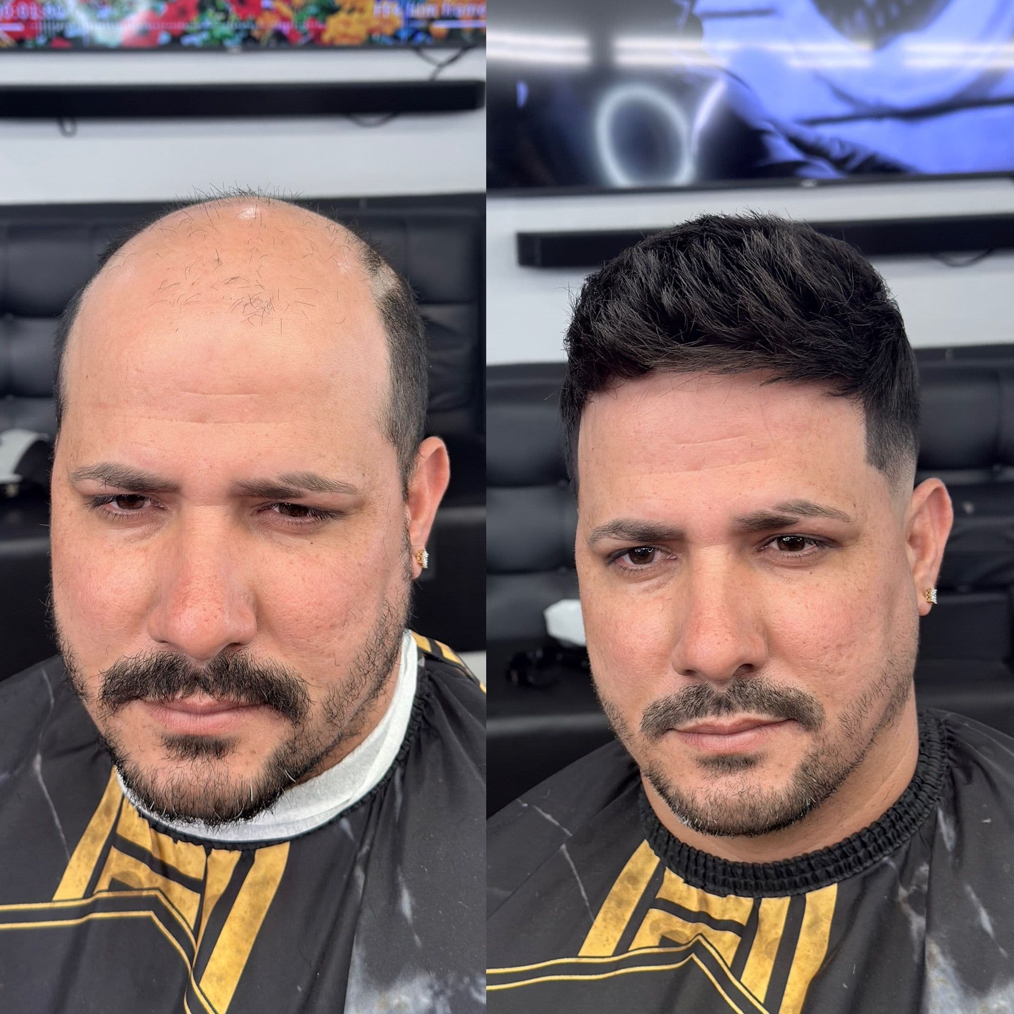 Transformación 8 — Antes y Después